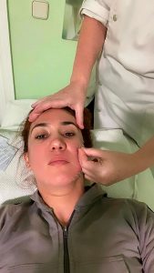 paralisis facial acupuntura nadia