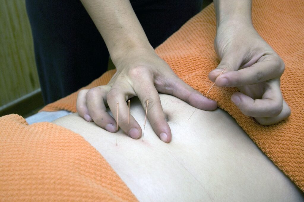 Acupuntura para fertilidad en Madrid